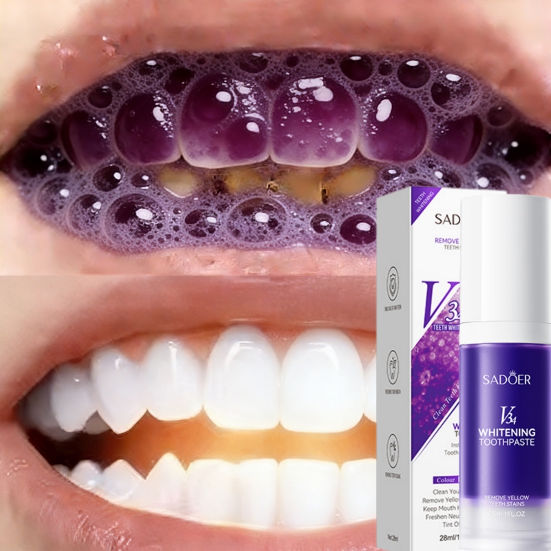 Teeth Whitening Effective - Dentifrice blanchissant best-seller 2026 : Élimine