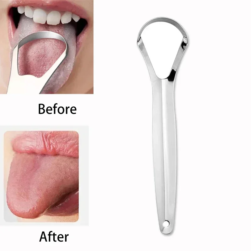 Tongue Scraper Metal - Grattoir à Langue en Acier Inoxydable