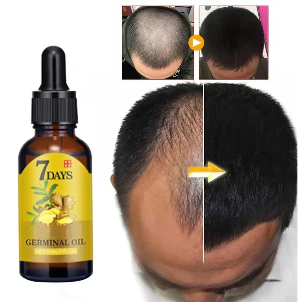 Coconut Oil Pull - Huile essentielle de gingembre pour la