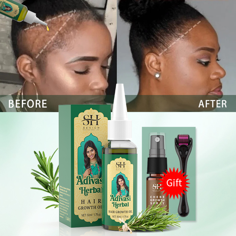 Huile de croissance capillaire - Coconut Oil Pull avis et prix