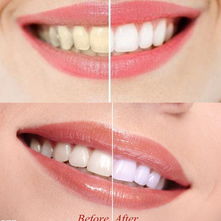 Poudre de charbon de bambou po - Teeth Whitening Filter avis et prix