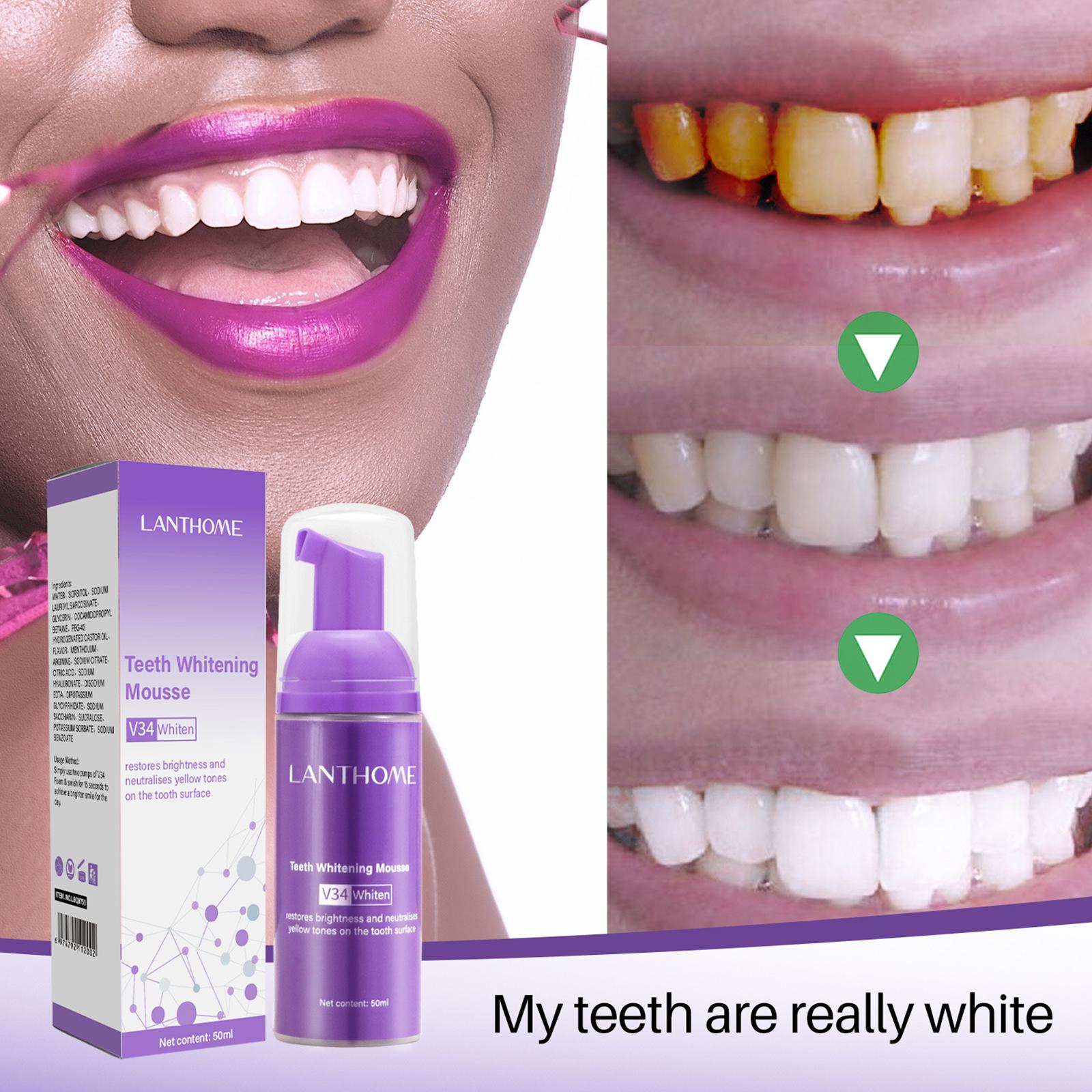 V34 Mousse nettoyage des dents - Teeth Whitening Effective avis et prix