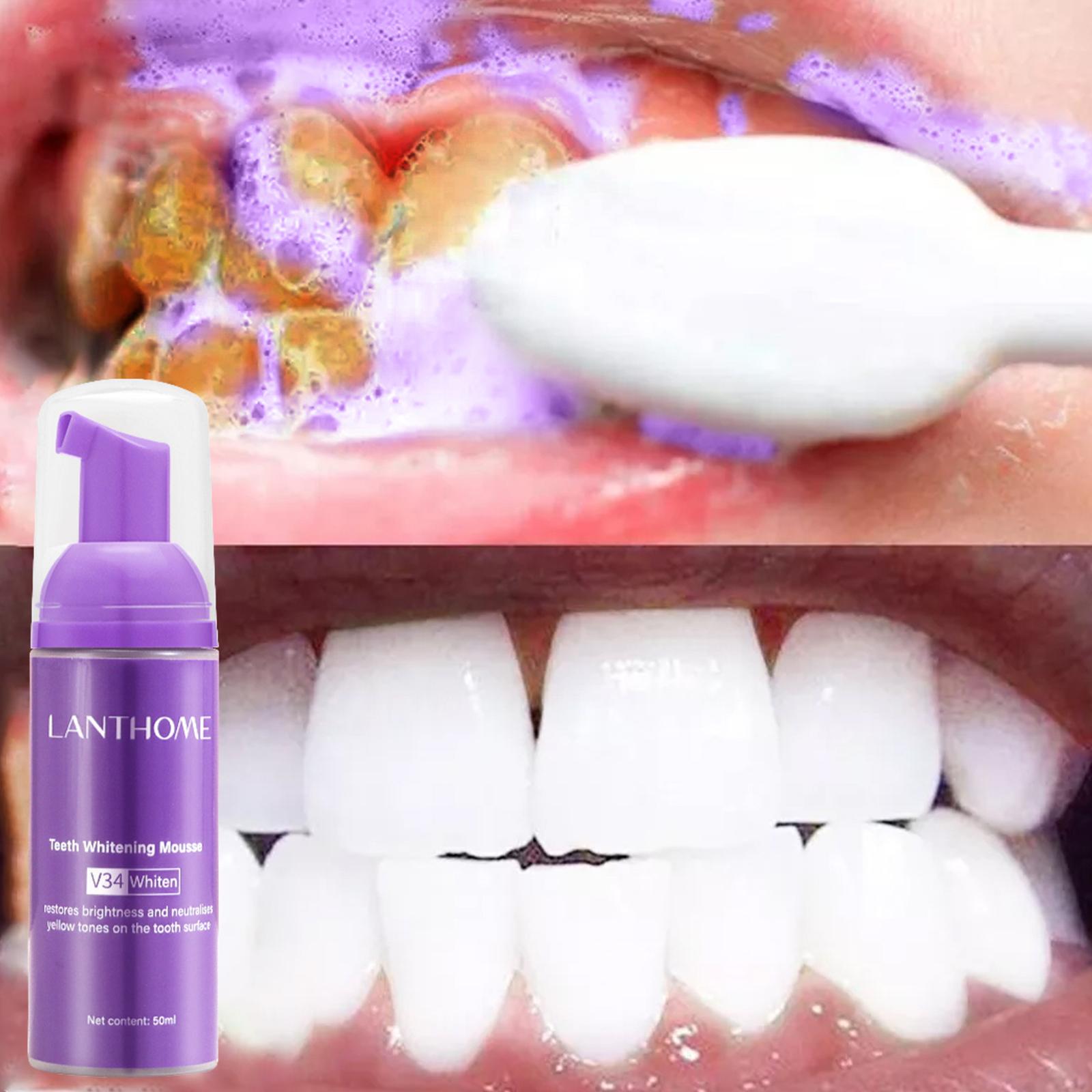 V34 Mousse nettoyage des dents - Teeth Whitening Effective avis et prix