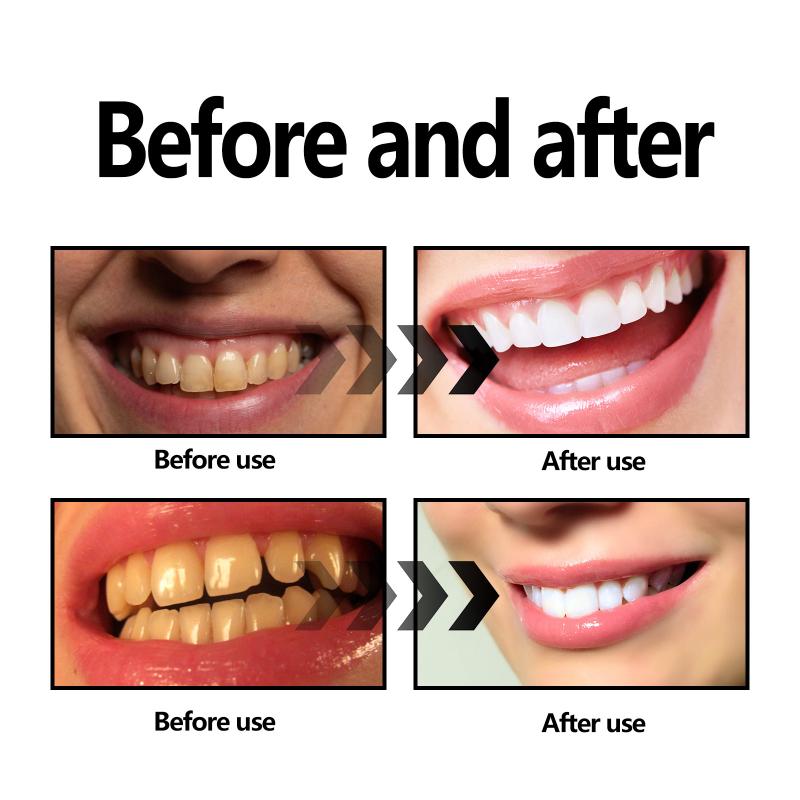 Poudre de charbon de bambou po - Teeth Whitening Filter avis et prix