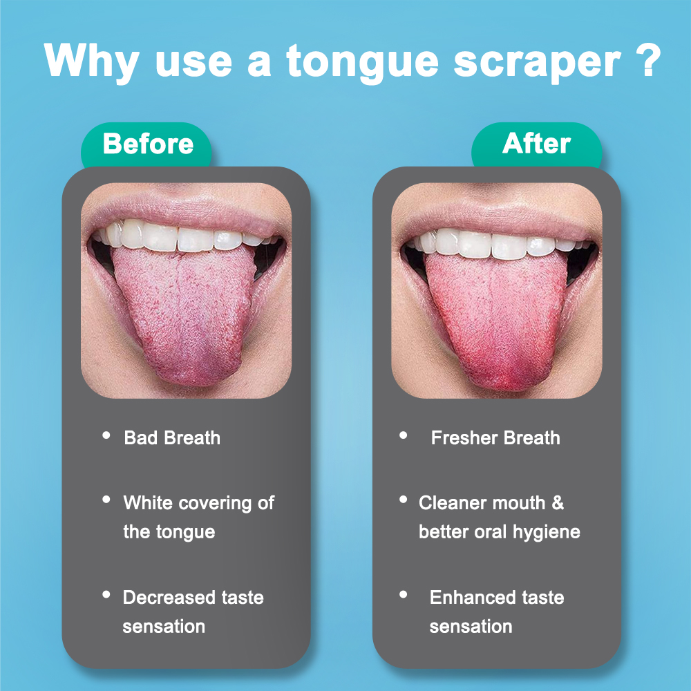 Grattoir à langue en acier ino - Tongue Scraper Metal avis et prix