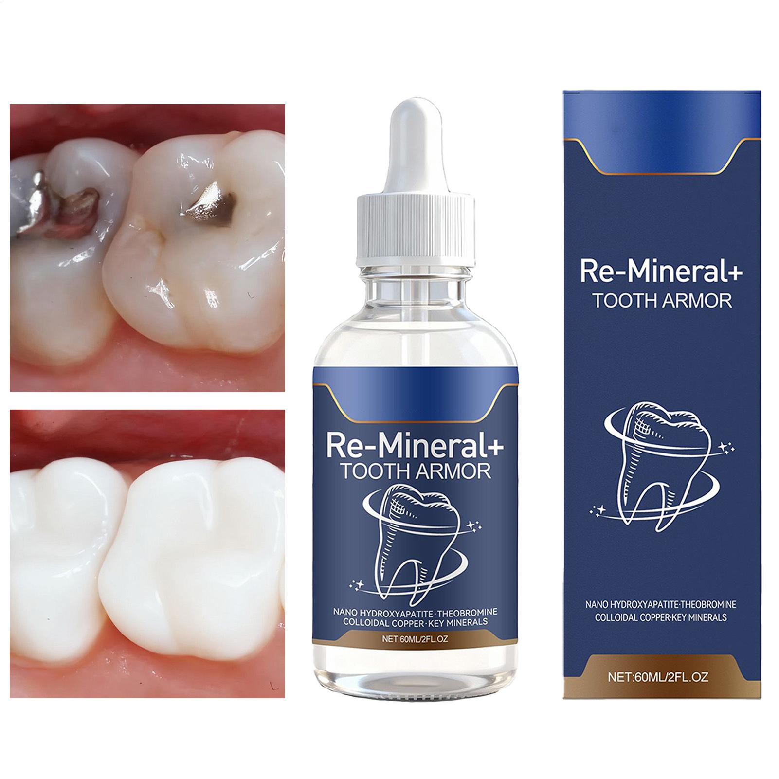 Liquide nettoyant pour dents 6 - Teeth Whitening Products avis et prix
