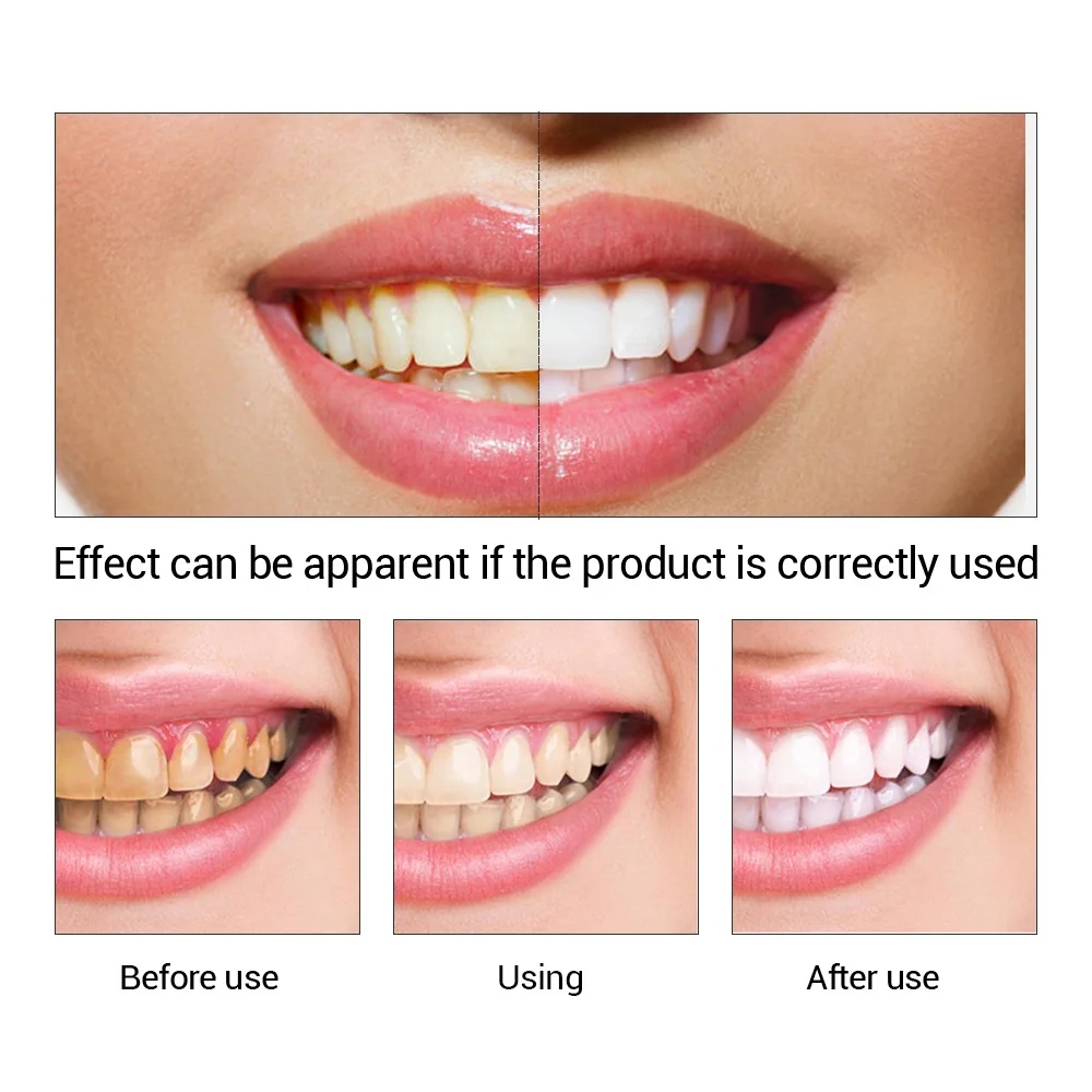 FTEENPLY poudre d'essence de b - Teeth Whitening Best avis et prix