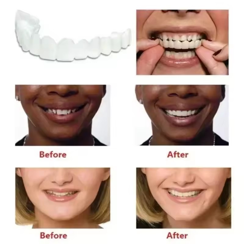 Veneers dentaires blanchissant - Teeth Whitening Vape avis et prix