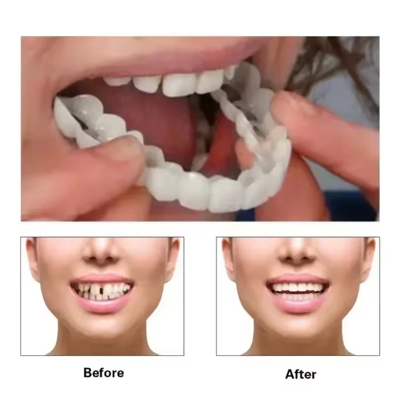 Veneers dentaires blanchissant - Teeth Whitening Vape avis et prix