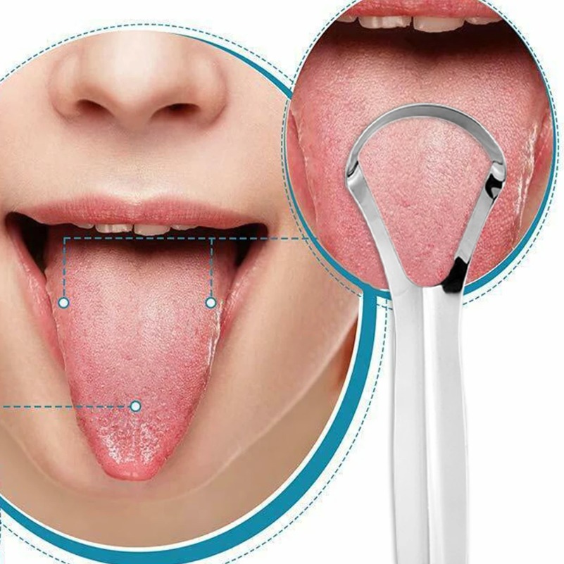 Grattoir de langue propre diss - Tongue Scraper Metal avis et prix