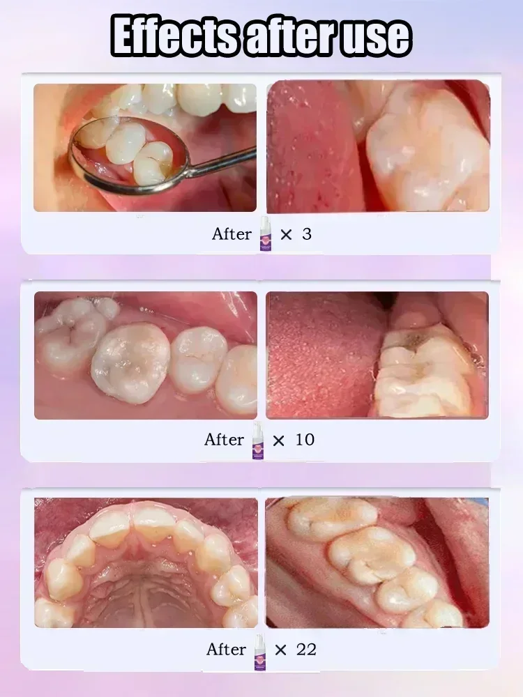 Réparation des caries, réparat - Teeth Whitening Charcoal Powder avis et prix