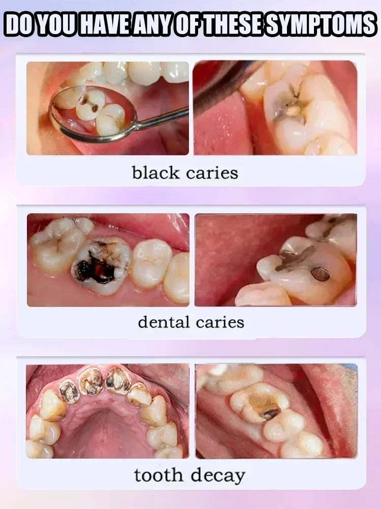 Réparation des caries, réparat - Teeth Whitening Charcoal Powder avis et prix