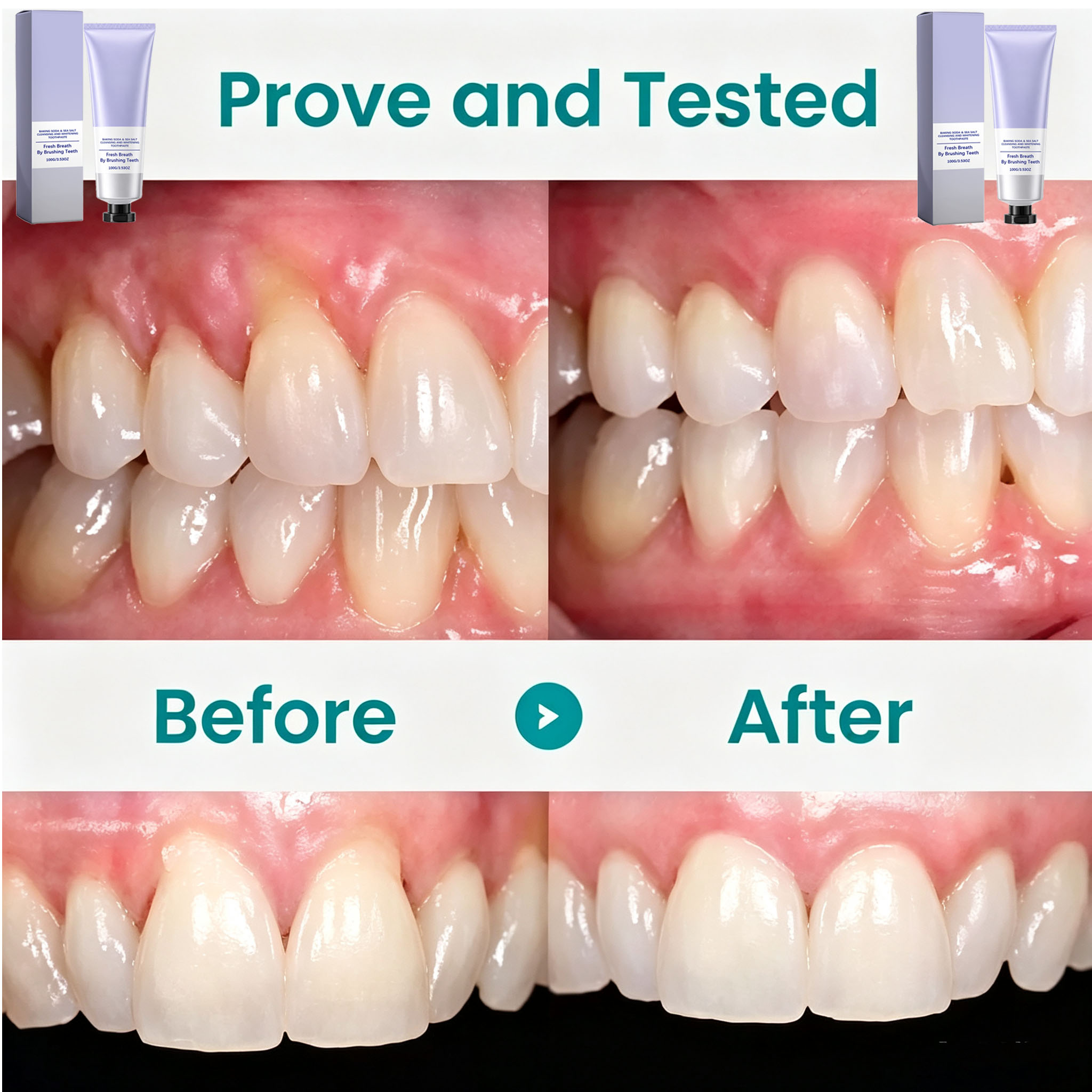 Dentifrice au bicarbonate de s - Teeth Whitening With Baking Soda avis et prix