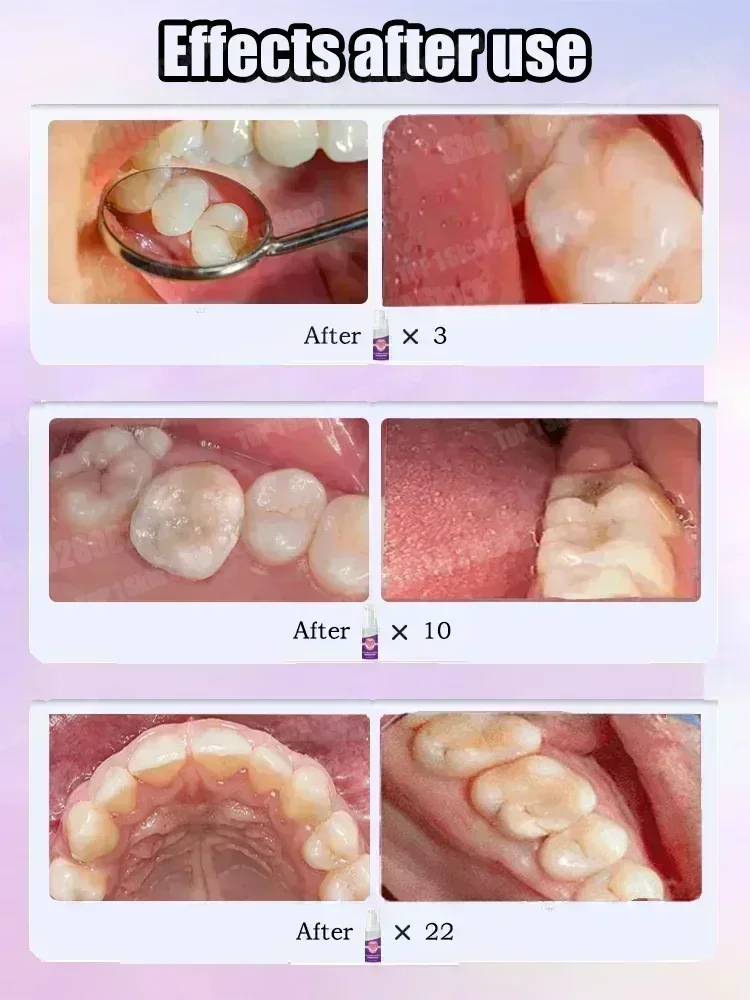 Offres spéciales Best-seller,  - Teeth Whitening Best avis et prix