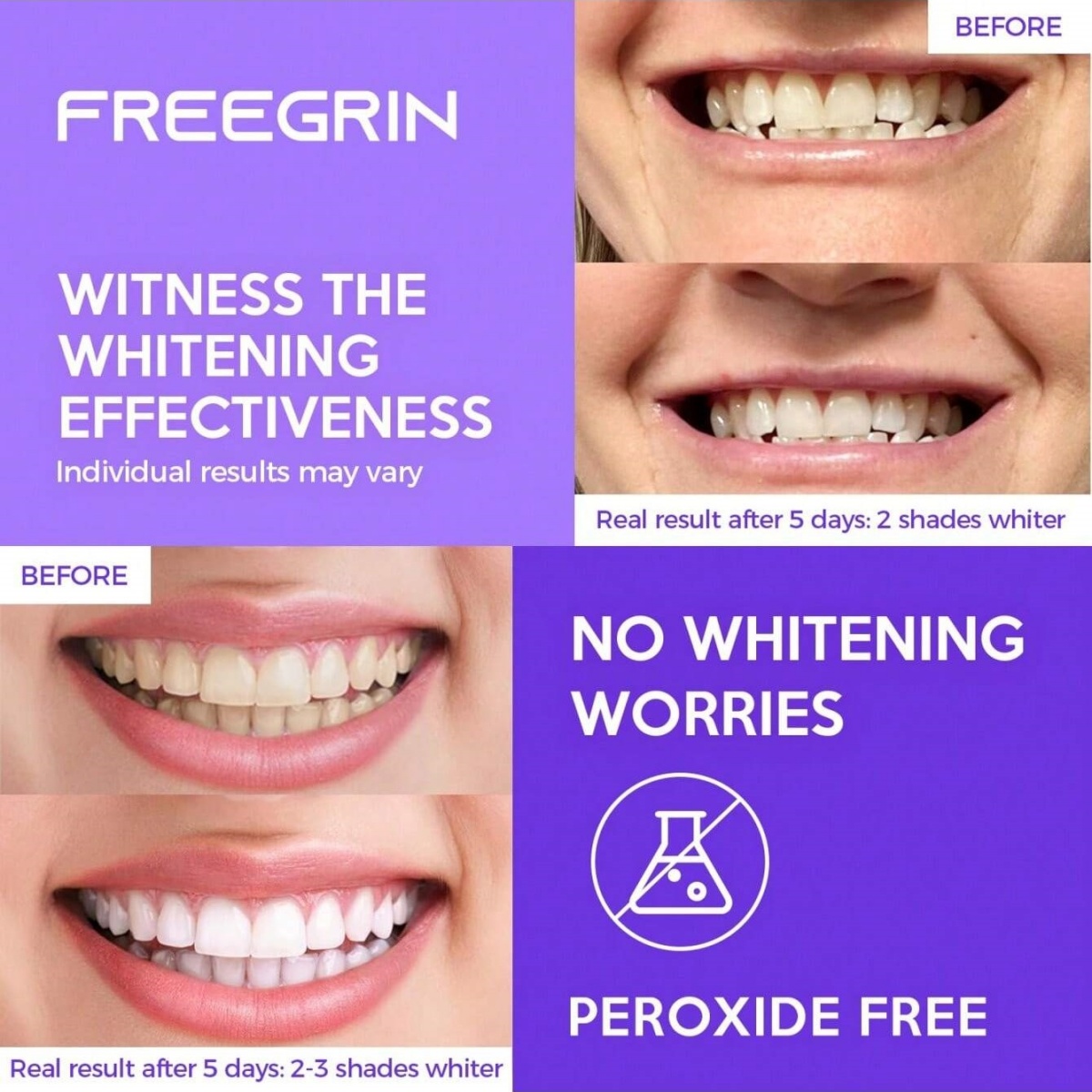 Autocollants de blanchiment de - Teeth Whitening Hydrogen Peroxide avis et prix