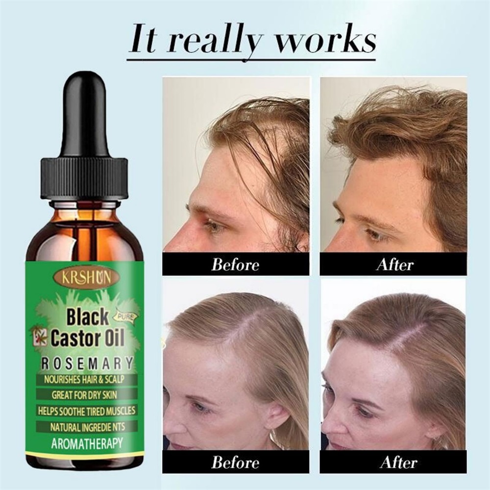 Huile de ricin noire nourrit l - Coconut Oil Pull avis et prix