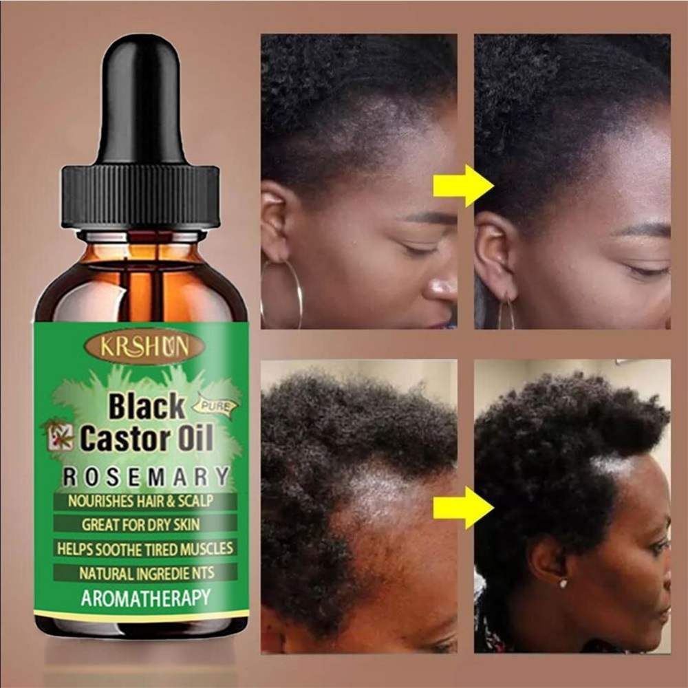 Huile de ricin noire nourrit l - Coconut Oil Pull avis et prix